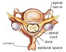 تزریق اپیدورال (epidural injection)